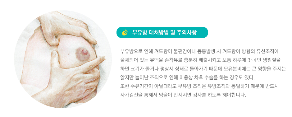 부유방 대체방법 및 주의사항에 대한 설명 사진