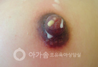 유구염 대표 사진